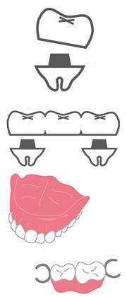 冠・ブリッジや入れ歯